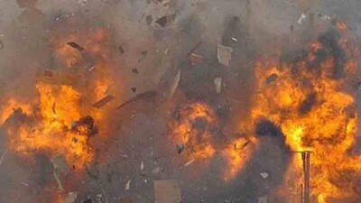 Odisha Youth Loses Fingers In Explosion While Conducting Experiment Watching YouTube