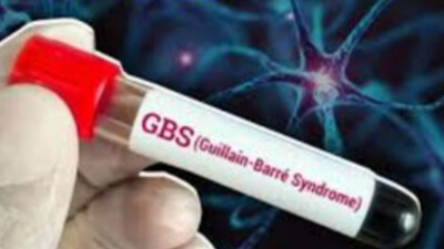 GBS outbreak: Mumbai reports first death