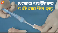 Bone Glue
