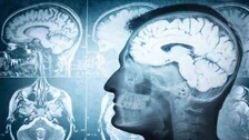 Human-brain