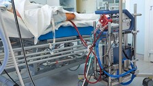 ECMO Facility Rollout At Cuttack SCB From August 15