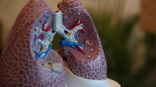 Post Diwali, Delhi Hospital Sees 10% More Respiratory Problem Patients