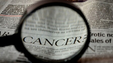 Chemotherapy May Not Be Needed To Treat Cancer: New Research