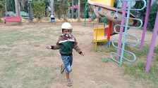 Separated Craniopagus Twin Jaga