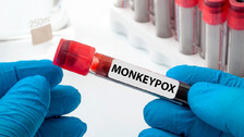 Monkey Pox