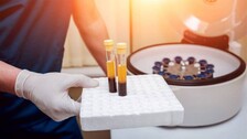 Plasma-therapy