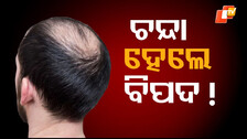 baldness
