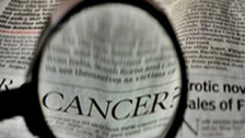 Cancer