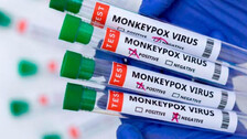 Mpox